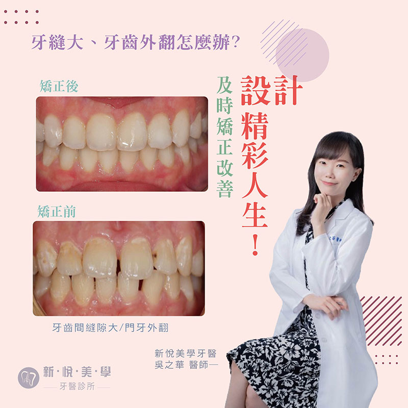 及時矯正，設計精彩人生！的第1張圖片